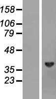 Biliverdin Reductase(BLVRA) (NM_000712) Human Tagged ORF Clone