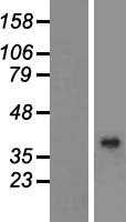 BHMT2 (NM_017614) Human Tagged ORF Clone