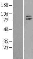 ZNF41 (NM_153380) Human Tagged ORF Clone
