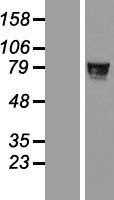 ZNF526 (NM_133444) Human Tagged ORF Clone