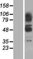 ZBTB43 (NM_001135776) Human Tagged ORF Clone
