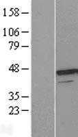 UROD (NM_000374) Human Tagged ORF Clone