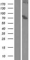15 Lipoxygenase 2(ALOX15B) (NM_001039131) Human Tagged ORF Clone