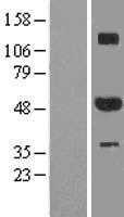 ZNF213 (NM_004220) Human Tagged ORF Clone