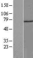 ZNF583 (NM_152478) Human Tagged ORF Clone