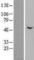 ZNF436 (NM_030634) Human Tagged ORF Clone