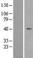 ZNF566 (NM_001145344) Human Tagged ORF Clone