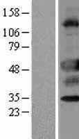 ZU5(UNC5CL) (NM_173561) Human Tagged ORF Clone