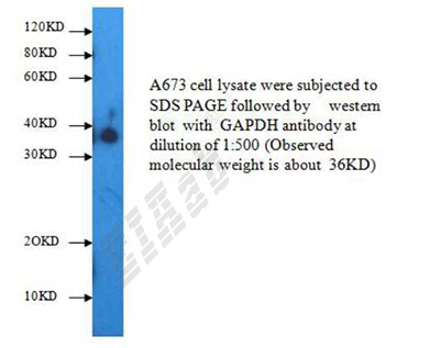 Human GAPDH Polyclonal Antibody