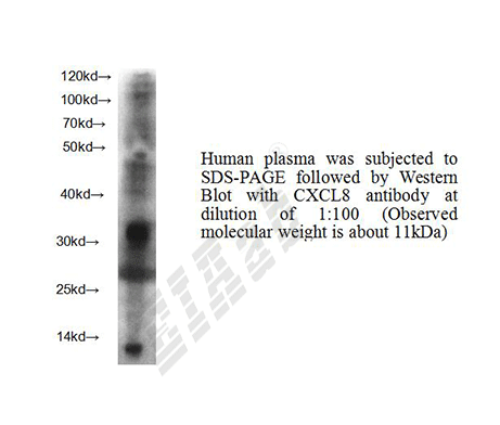 Human CXCL8 Polyclonal Antibody