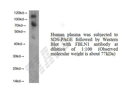 Human FBLN1 Polyclonal Antibody