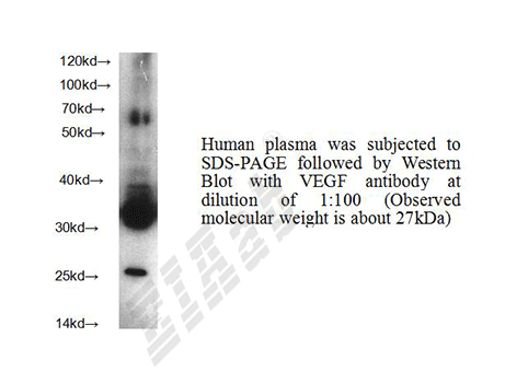 Human VEGFA Polyclonal Antibody