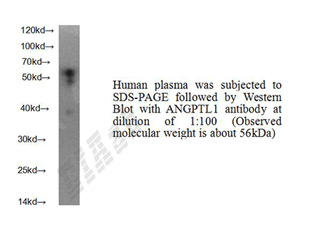 Human ANGPTL1 Polyclonal Antibody