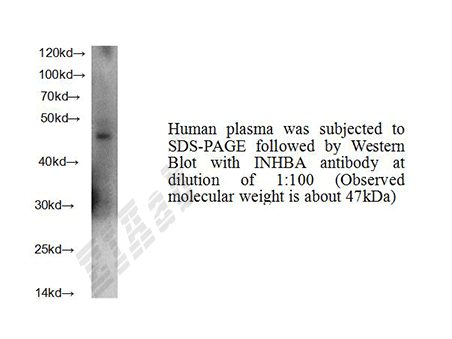 Human INHBA Polyclonal Antibody