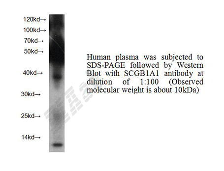 Human SCGB1A1 Polyclonal Antibody