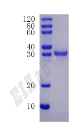 Human BDNF Protein