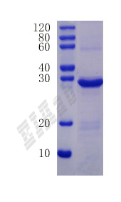 Mouse Igf1 Protein