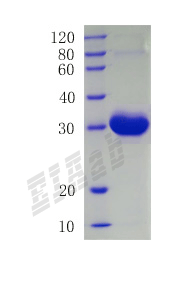 Human CCL3 Protein
