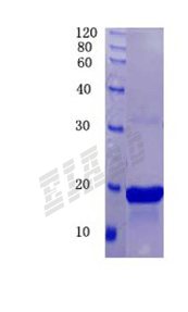 Human NT5E Protein