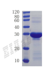 Human CCL5 Protein