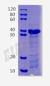 Human SFTPD Protein