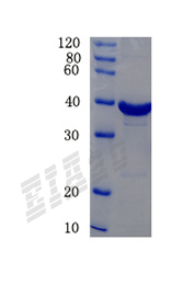 Human SNCA Protein