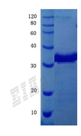 Human ACTA2 Protein