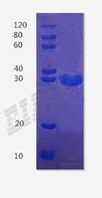 Human TNNT1 Protein