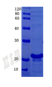 Human CASP8 Protein