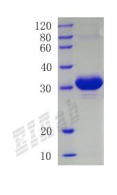 Human MAP1LC3B Protein