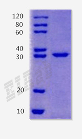 Human TIGAR Protein