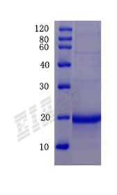 Mouse Fmr1nb Protein