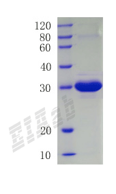 Human ANGPTL1 Protein