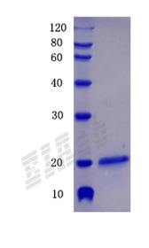 Human CHRNA7 Protein