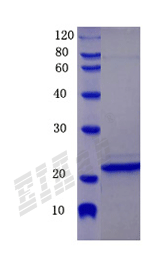 Human ABCC4 Protein