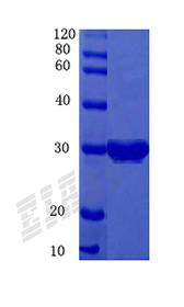 Human AQP1 Protein