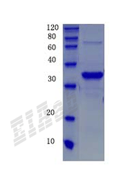 Human AQP2 Protein