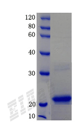 Human TNFAIP6 Protein