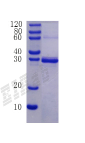 Human CCL24 Protein