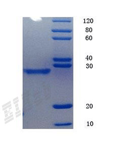 Human ORM1 Protein