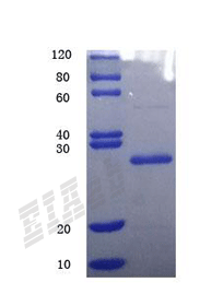 Human MFSD2A Protein