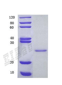 Human ADTRP Protein