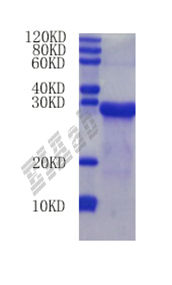 Mouse Havcr1 Protein
