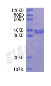 Human ATAD3B Protein