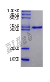 Human SPP1 Protein