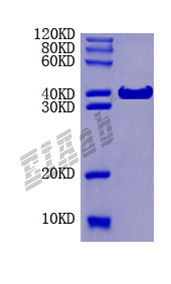 Human CD68 Protein