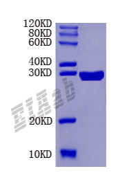 Mouse Tnfrsf17 Protein