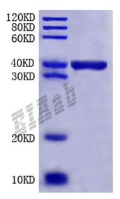 Mouse Fgl1 Protein