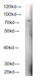 Human TMSB4X Polyclonal Antibody
