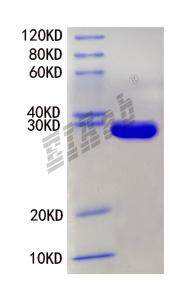 Human SLC30A8 Protein